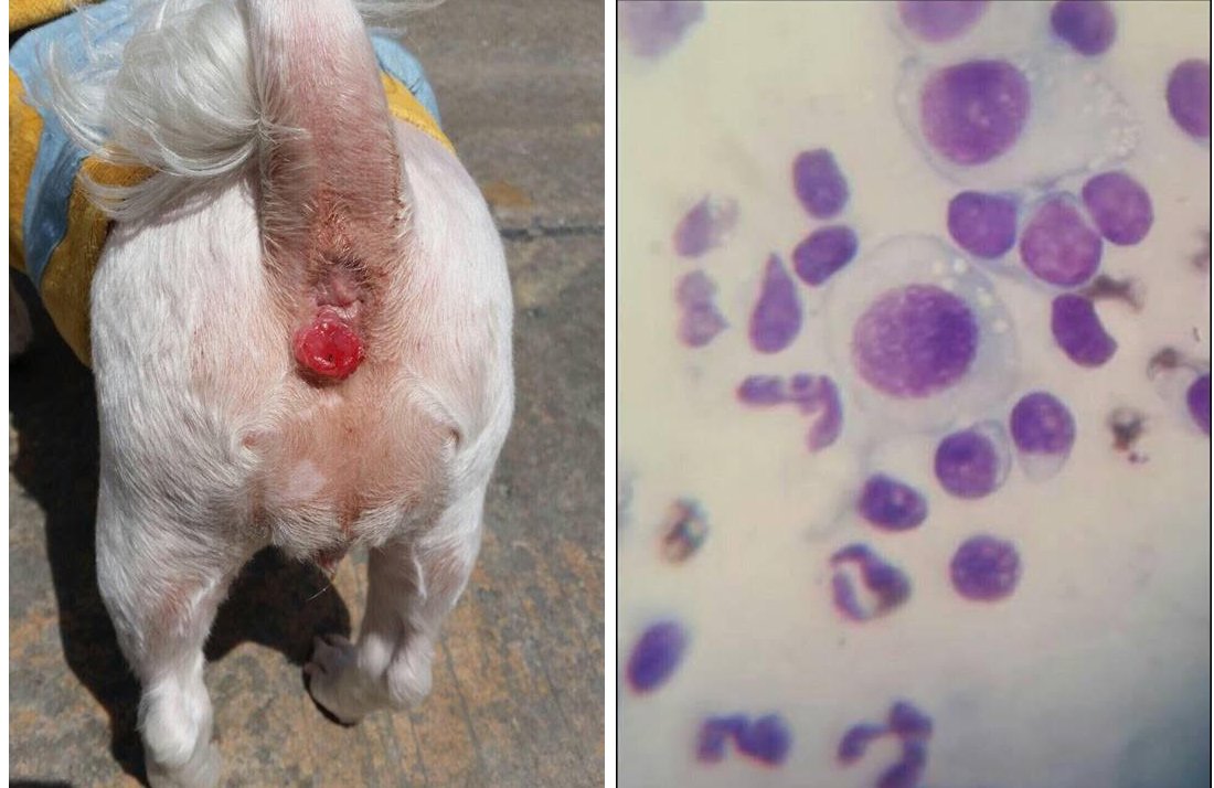 “เนื้องอกสติ๊กเกอร์ แปะปุ๊บ ติดปั๊บ” “เนื้องอกสติ๊กเกอร์ แปะปุ๊บ ติดปั๊บ”